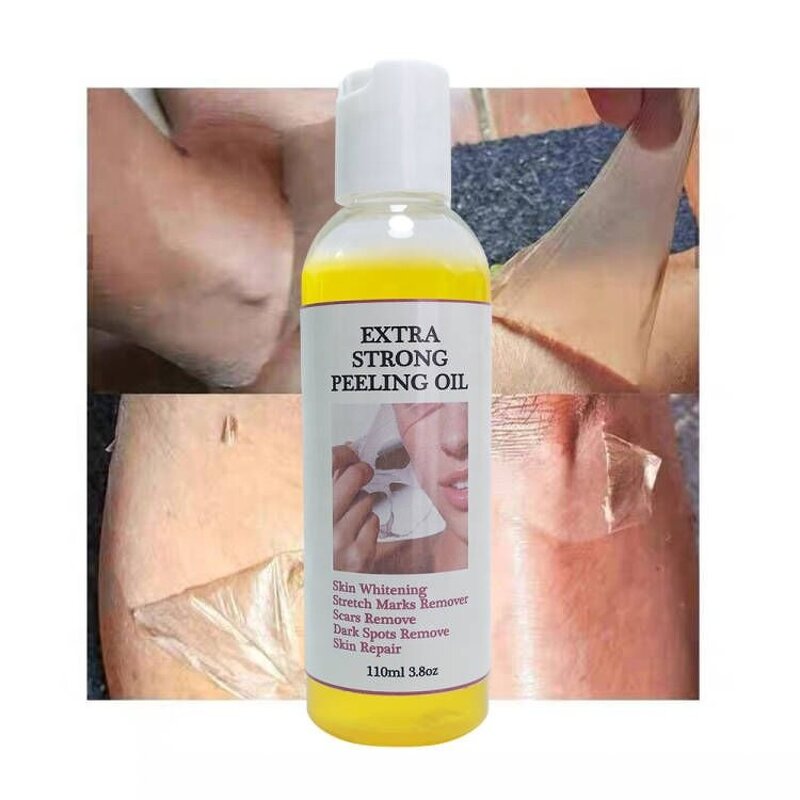 Aloe Peeling Oil - Manufacturer - Private Label Revitalizer Yellow Orange Face Body Whitening