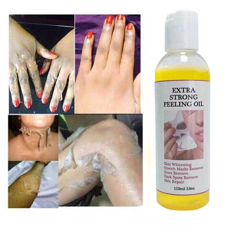Aloe Peeling Oil - Manufacturer - Private Label Revitalizer Yellow Orange Face Body Whitening