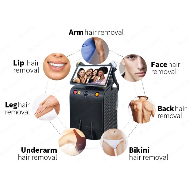 Diode Laser Hair Removal Machine Supplier - 755 808 1064nm 808nm