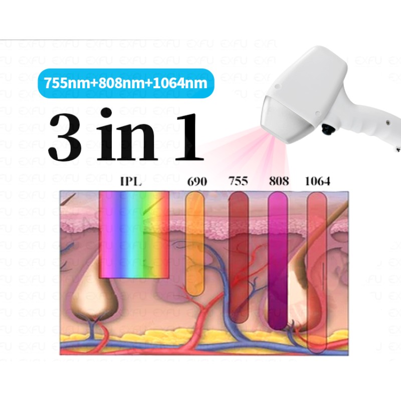 Clinical Diode Laser Hair Removal Machine Supplier - 755 808 1064nm