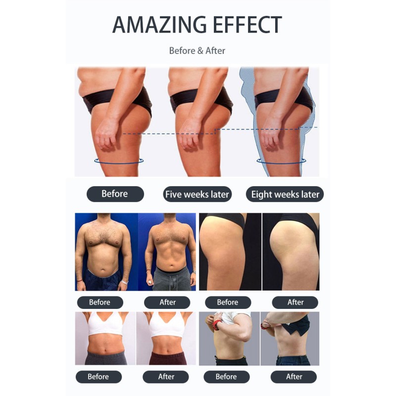 16Tesla Body Shaping Machine Manufacturer - EMS RF Fat Burning