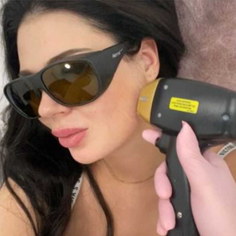 Diode Laser Hair Removal Machine Supplier - 755 808 1064nm 808nm