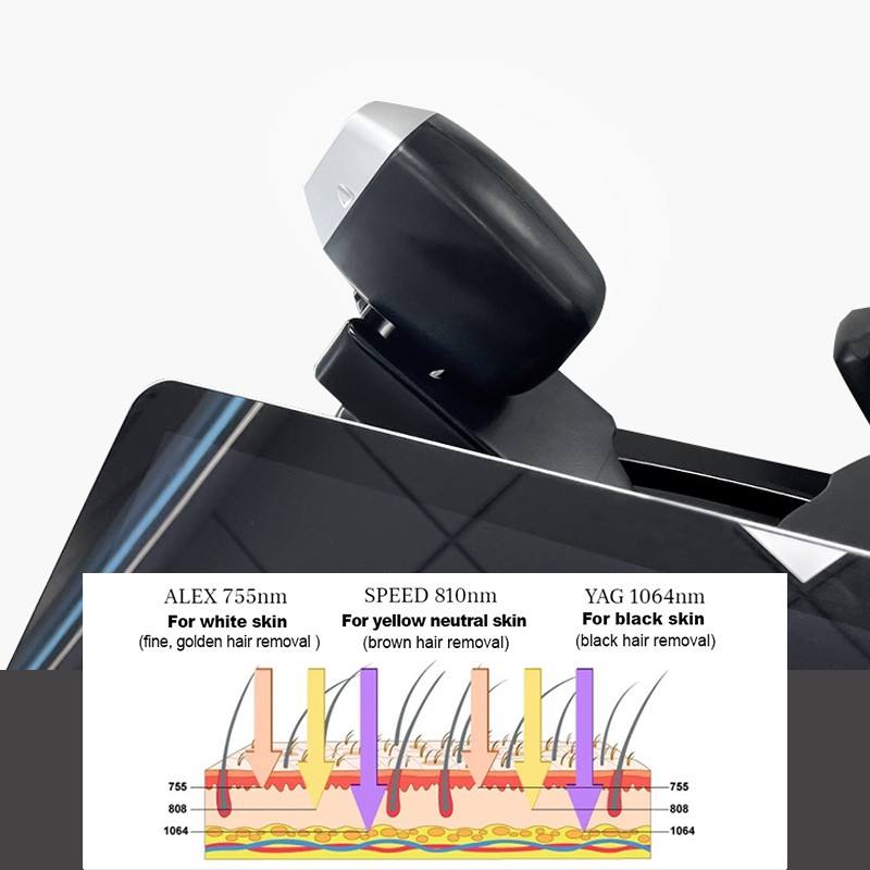 4 Laser Hair Removal Machine Factory - Nd Yag Diode Face Lips