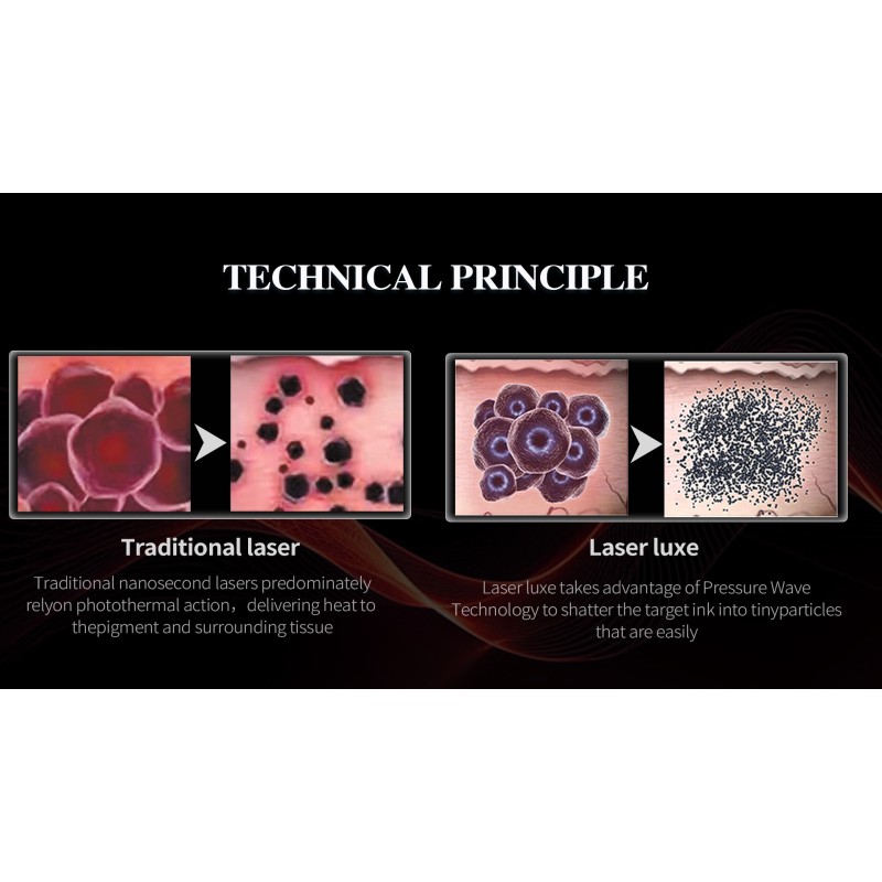 Portable Picosecond Laser Machine Manufacturer - 3000W Best Price