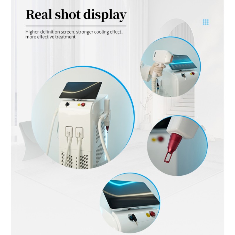 Professional Nd Yag Laser Machine Supplier - Q Switched Tattoo Removal