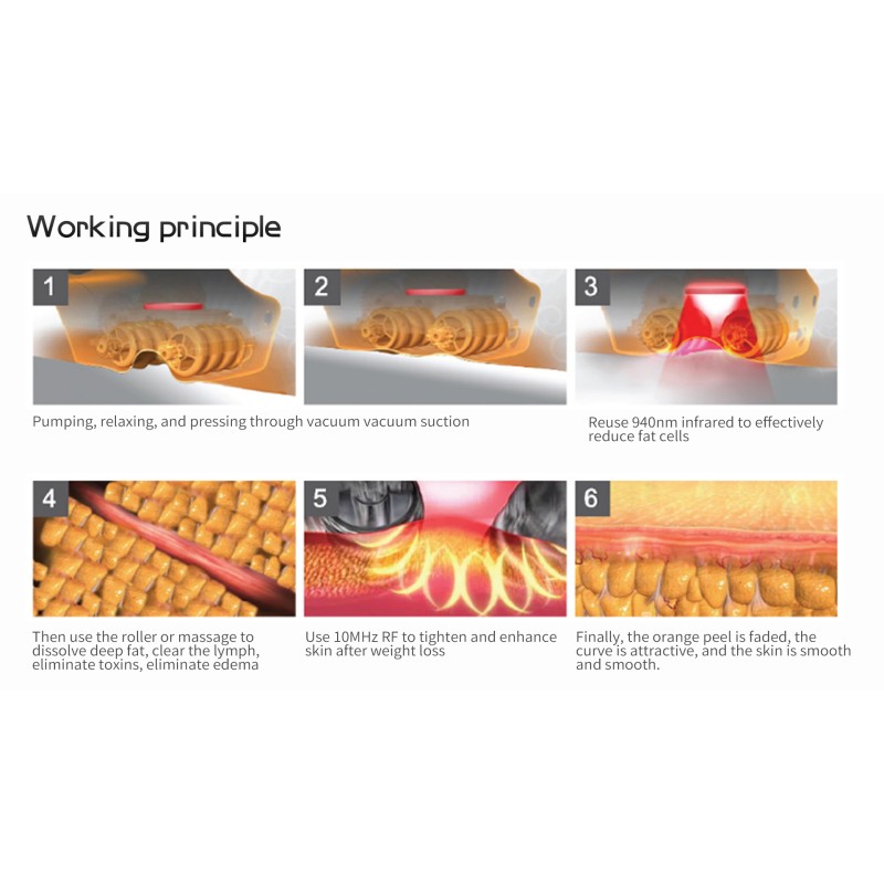 Facial Body Slimming Machine Factory - Vacuum Cavitation Roller