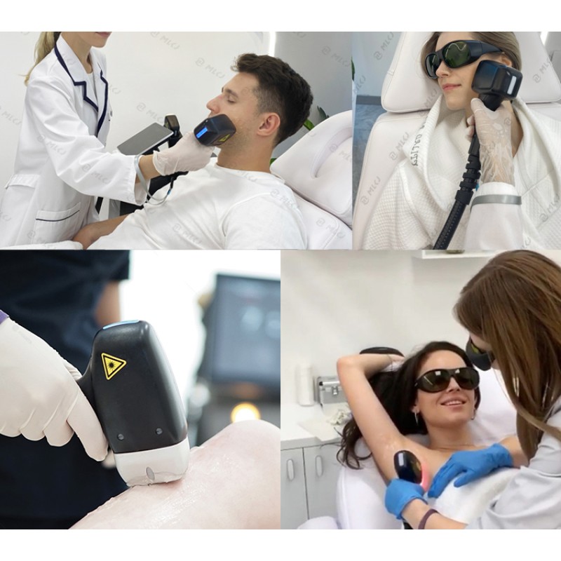 Diode Laser Hair Removal Machine Supplier - 755 808 1064nm 808nm
