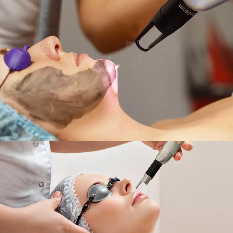 Tattoo Removal Laser Machine Manufacturer - Face Treatment Multi Plug