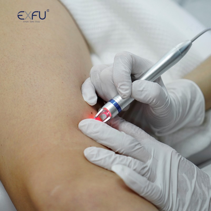 Triple Diode HIFU Machine Manufacturer - Handheld IPL Microneedle