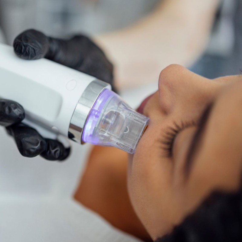 808 Titanium Diode Laser Factory - Pico RF Microneedling Gold