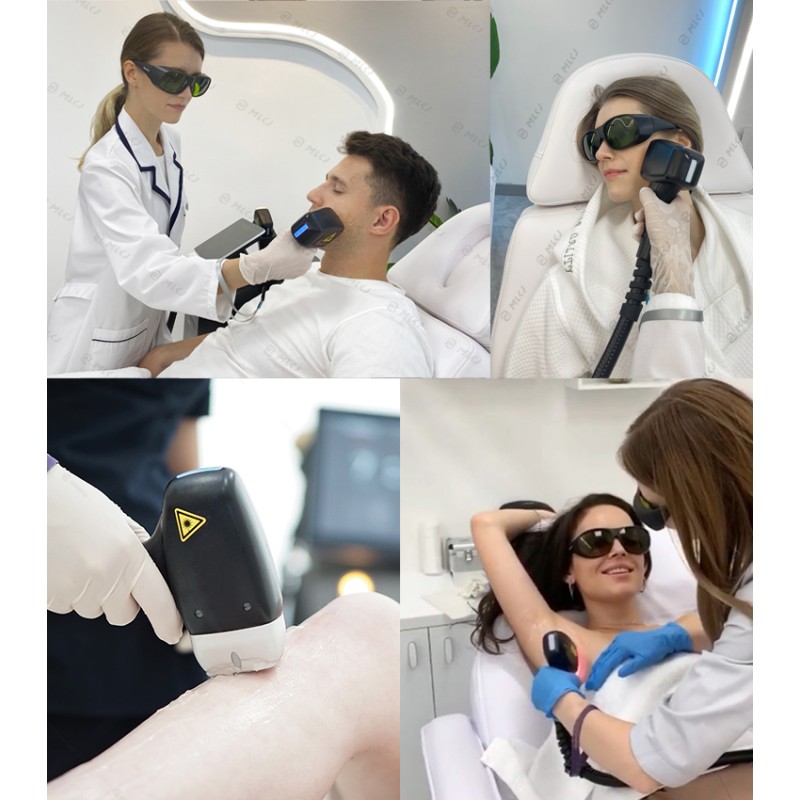 3 Waves Diode Laser Machine Manufacturer - 808nm Latest Technology