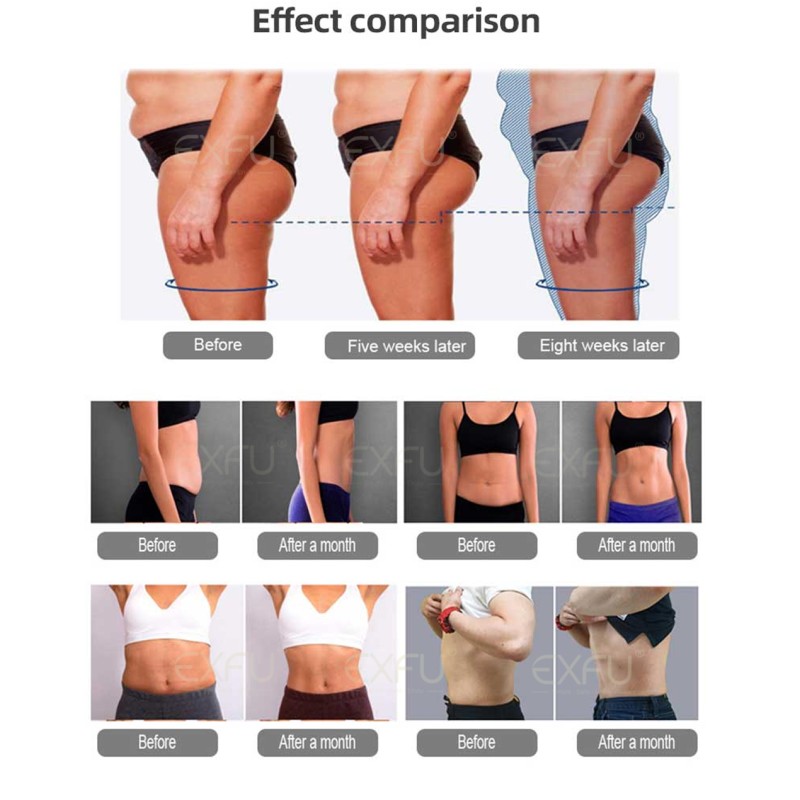 5D Laser Slimming Machine Manufacturer - EMS Body Sculpt Weight Loss