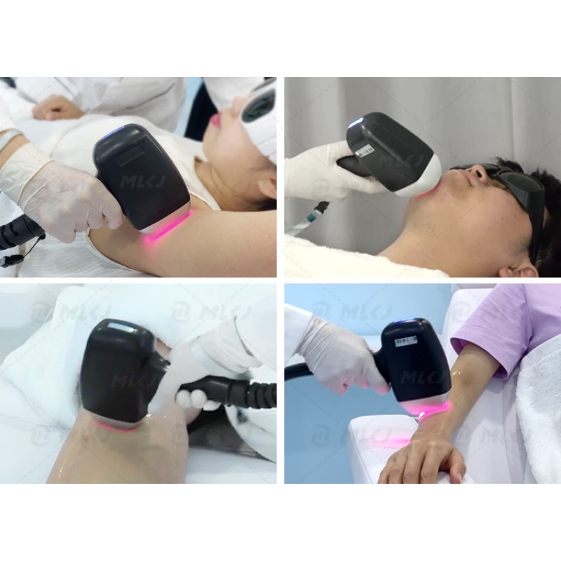 Upgrade Ice Diode Laser Machine Factory - 755 808 1064 Platinum