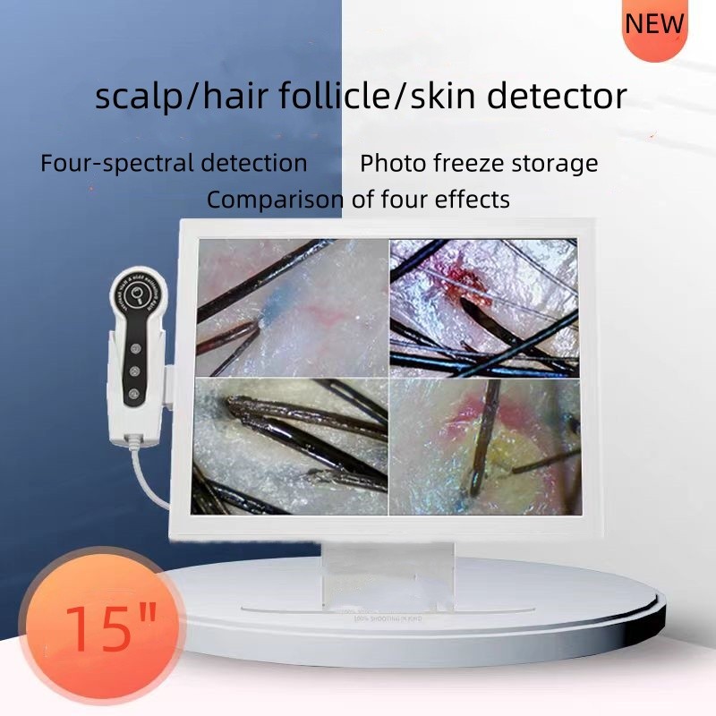 Digital HD Detector Factory - OEM 15-inch Hair Skin Analyzer Problem Detection