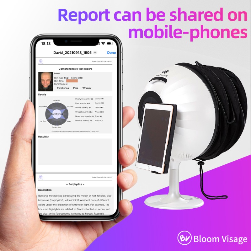 Magic Mirror Skin Analyzer Supplier - OEM 3D Facial Scanner with App Analysis
