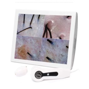 Skin Detector Factory - OEM Four Spectral Dual Probe Scalp Analysis Machine