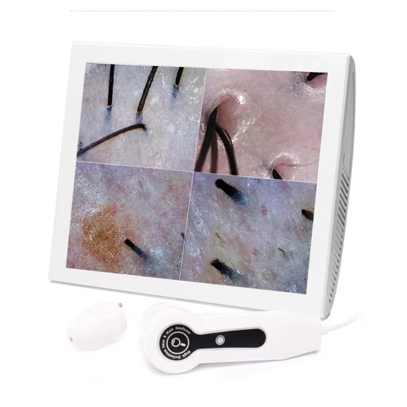 Skin Detector Factory - OEM Four Spectral Dual Probe Scalp Analysis Machine