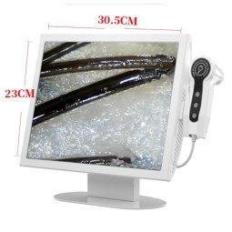 Digital HD Detector Factory - OEM 15-inch Hair Skin Analyzer Problem Detection