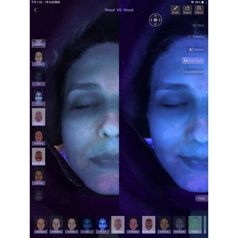 8 Spectrum Skin Analyzer Manufacturer - OEM BV Facial Analysis Machine