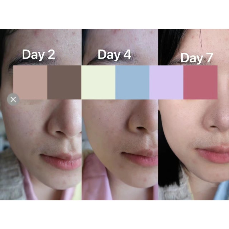 Skin Booster Manufacturer - OEM Non-invasive Patented Technology Innovation