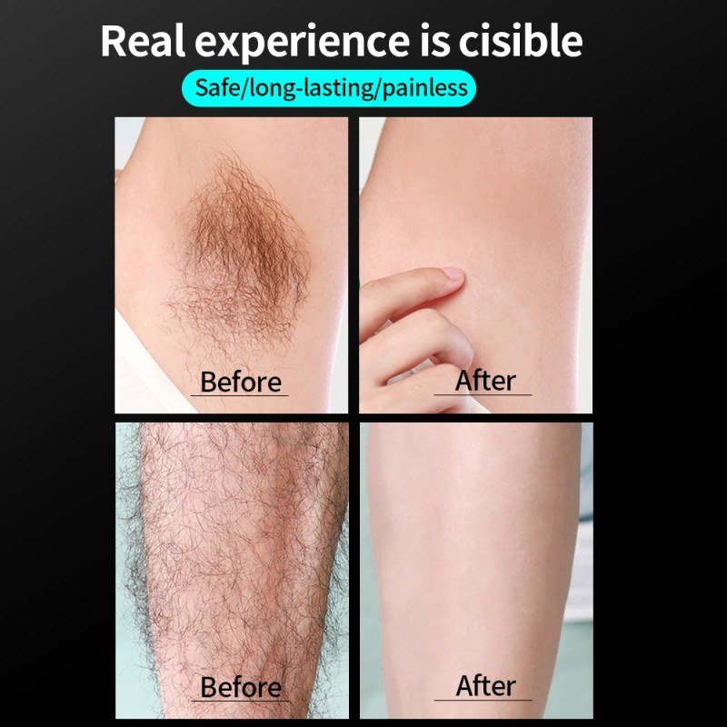 Body Shaping Manufacturer - OEM 7in1 Non-invasive Microelectrical Impulses Machine