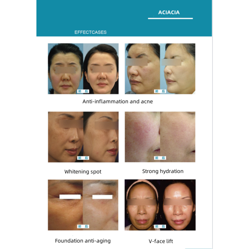 Anti-aging Equipment Manufacturer - OEM No Needle Mesotherapy Skin Booster