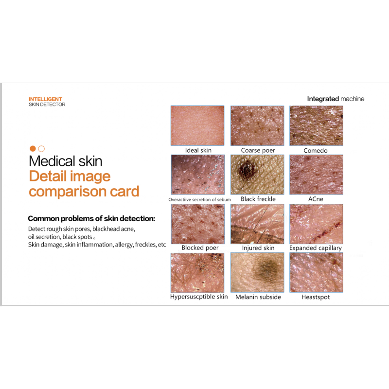 Scalp Analyzer Manufacturer - OEM Portable Skin Hair Analysis EU IT US Plugs