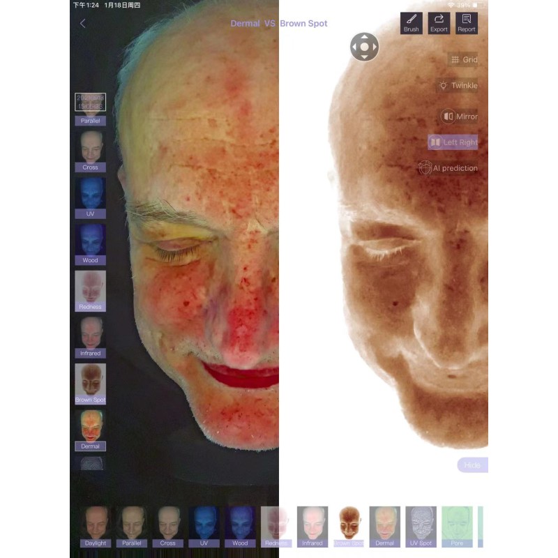 Portable Skin Analyzer Manufacturer - OEM Bloom Visage Facial Scanner Machine