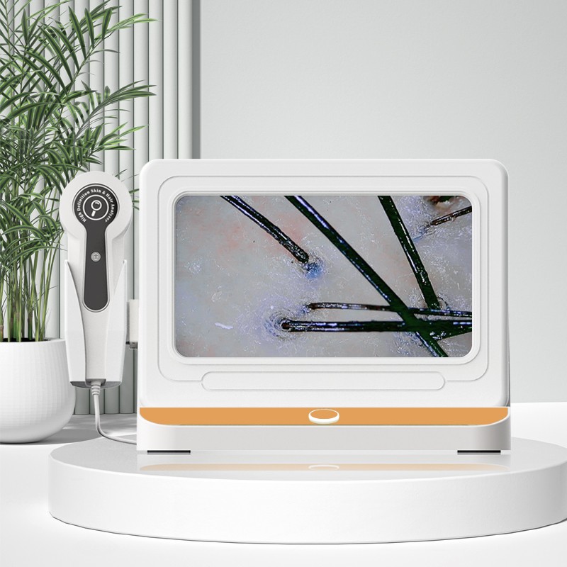 Digital HD Detector Factory - OEM 15-inch Hair Skin Analyzer Problem Detection