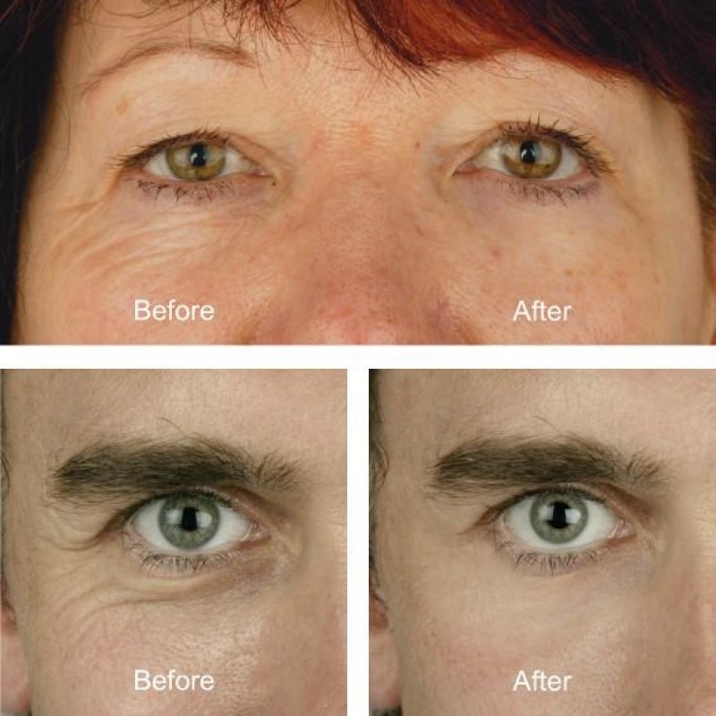 Eyelash Serum Factory - OEM Luxury Lash Enhancer Growth Serum Liquid