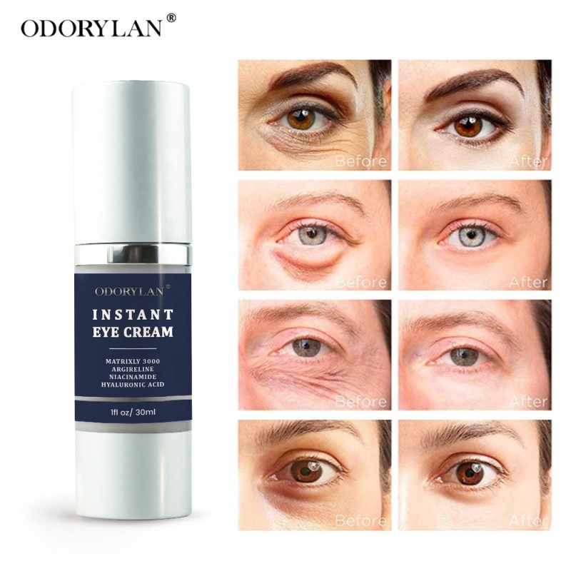 Puffy Eyes Cream Supplier - Private Label Relieve Smoothing Repairing Cream