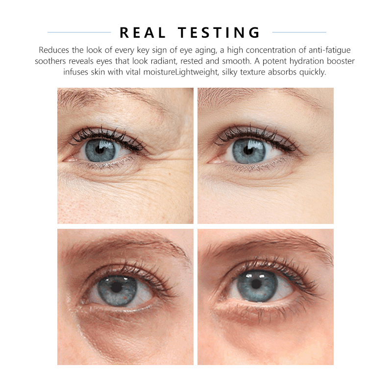 Korean Eye Cream Factory - OEM Lifting Massage Anti-Wrinkle Care Cream