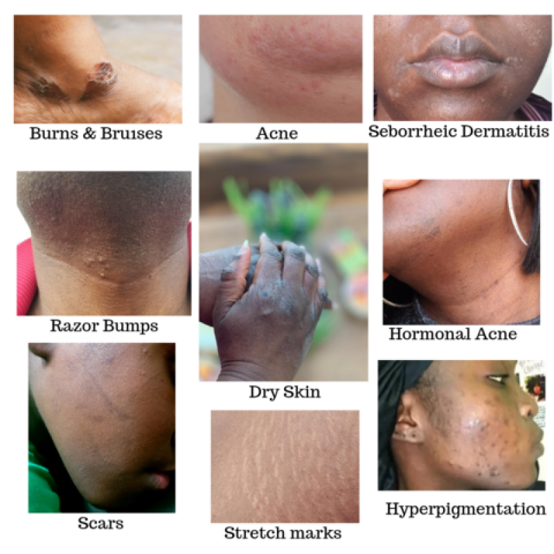 Turmeric Kojic Soap Manufacturer - Private Label Organic Honey Whitening Soap