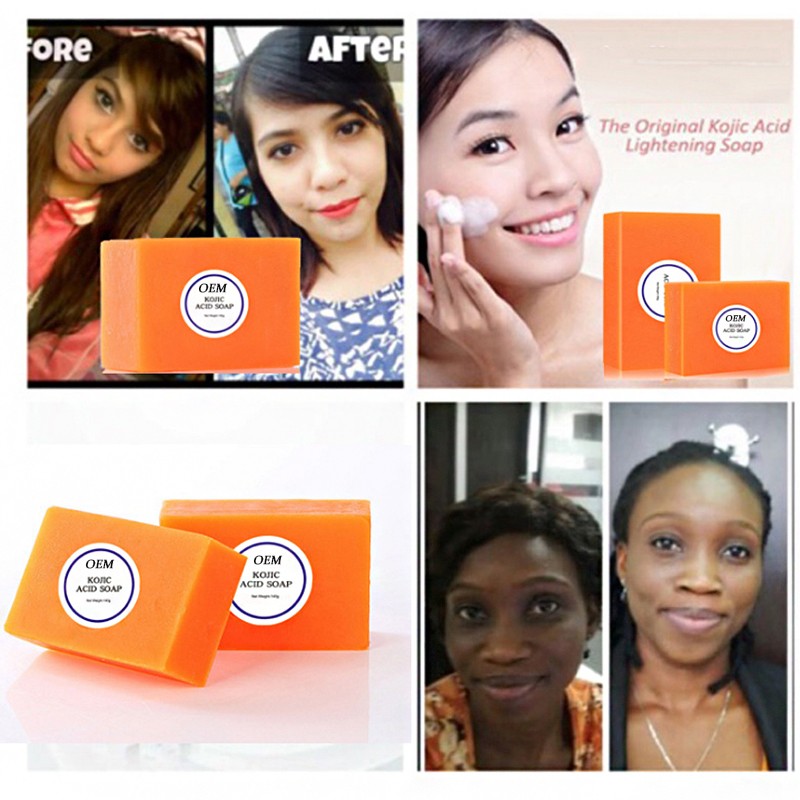 Natural Turmeric Soap Supplier - Private Label Anti Acne Dark Spots Soap