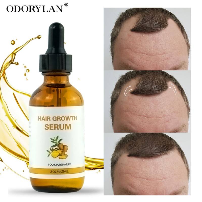 Hair Regrowth Serum Supplier - Private Label African Anti-Hair Loss Serum