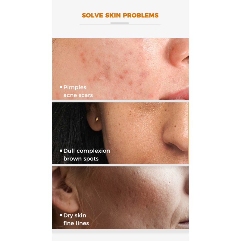 Organic Skin Care Factory - OEM Turmeric Scrub Serum Body Scrub Gel