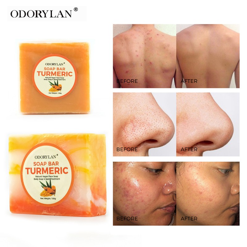 Lemon Turmeric Soap Supplier - OEM Sulfur Lightening 250g Kojic Acid Soap