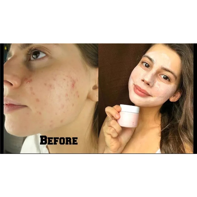 Pink Clay Mask Factory - OEM Rose Clay Purifying Pores Oil Control Mask