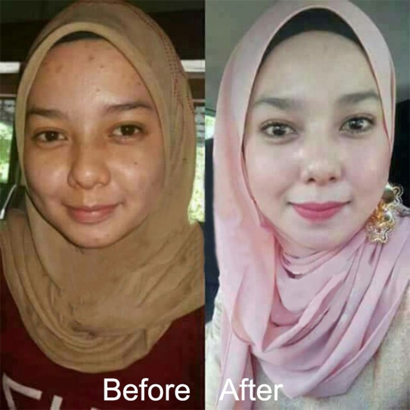 BB Cream Foundation Manufacturer - OEM Beauty Salon Semi Permanent Serum Kit