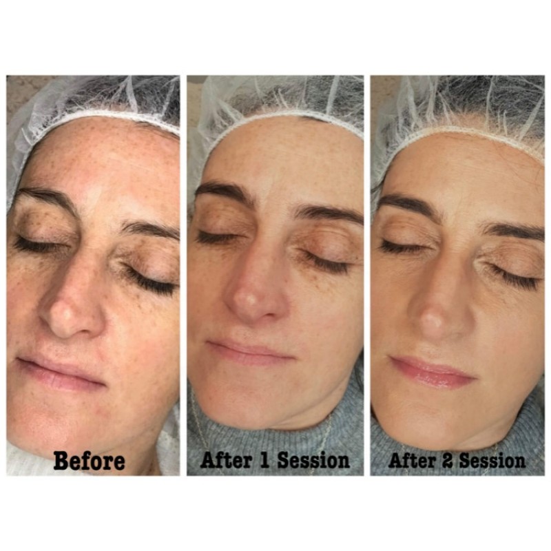 BB Cream Foundation Manufacturer - OEM Beauty Salon Semi Permanent Serum Kit