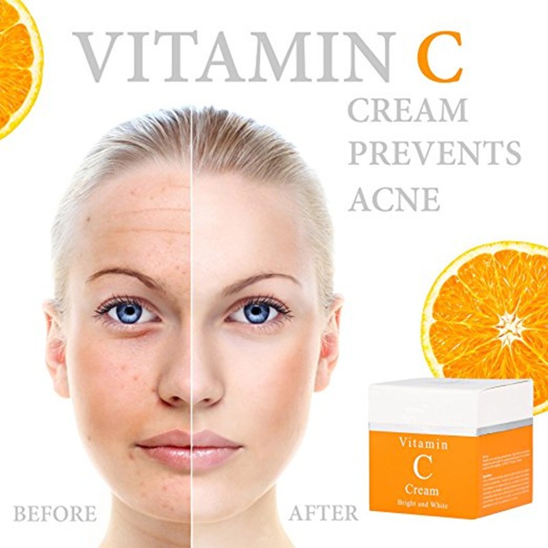 Anti Aging Cream Supplier - Private Label Vitamin C Whitening Moisturizing Cream