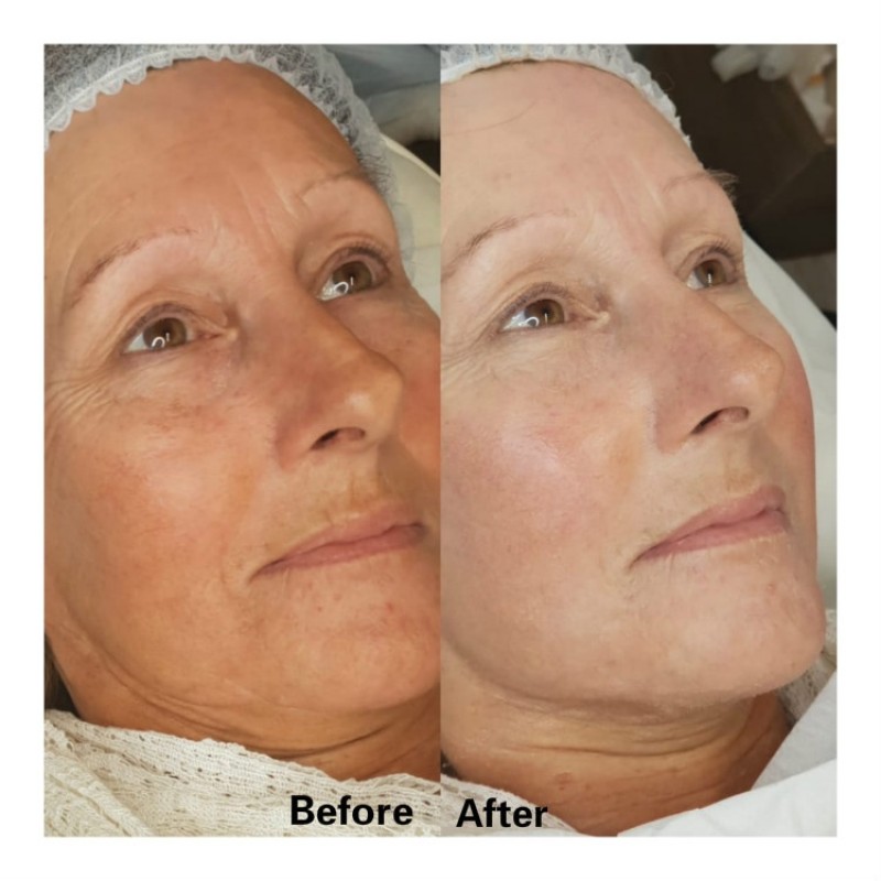 BB Starter Kit Manufacturer - OEM Full Stock Lips Foundation Treatment Serum