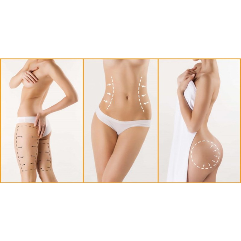 Anti-Cellulite Cream Factory - OEM/ODM Vegan Slimming Gel Vitamin C