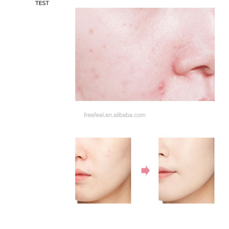 Cleansing Oil Factory - OEM Korean Skin Care Blackheads Removal Oil