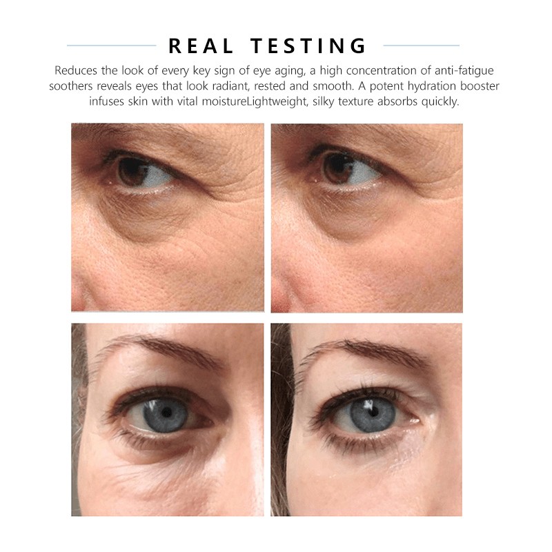 Eye Dark Circles Factory - OEM Korea Multi Pads Magic Pen Cream