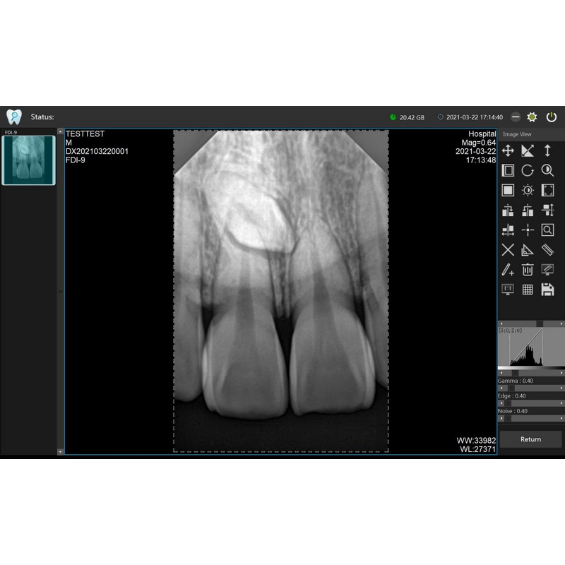 Dental X Ray Machine - Manufacturer - Ray Portable Digital Intraoral Sensor