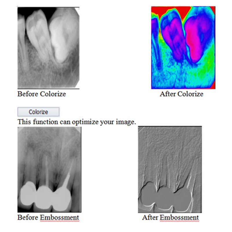Dental X-ray System - Manufacturer - Digital Intra Oral Image Sensors