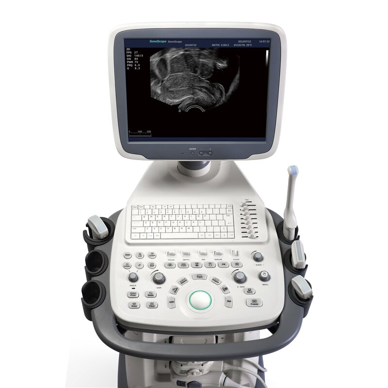 Trolley Ultrasound System - Manufacturer - S11 15 Inch LCD 3D 4D Color Doppler