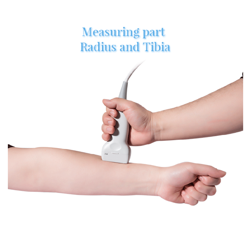 Bone Ultrasound Densitometer - Manufacturer - Medical Bone Density Testing Machine