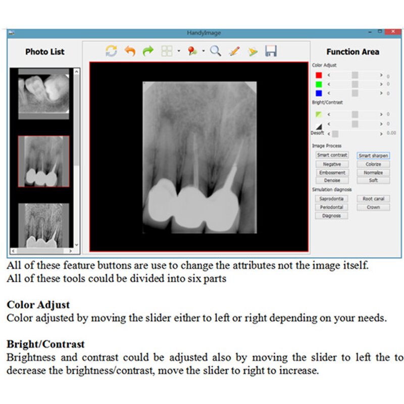 Dental X-ray System - Manufacturer - Digital Intra Oral Image Sensors